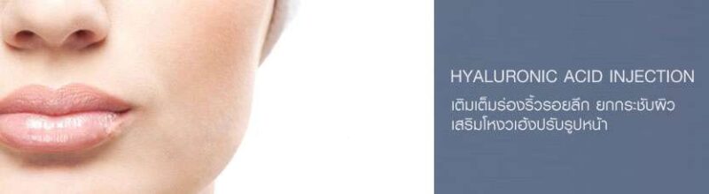 ทำความเข้าใจเรื่อง Filler เติมเต็มอย่าง 2 botox 051