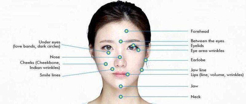 ทำความเข้าใจเรื่อง Filler เติมเต็มอย่าง 3 pic laser 17