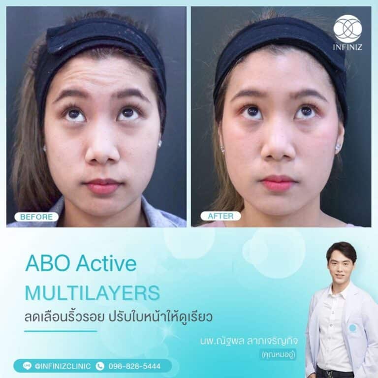 ABO Active 4 3