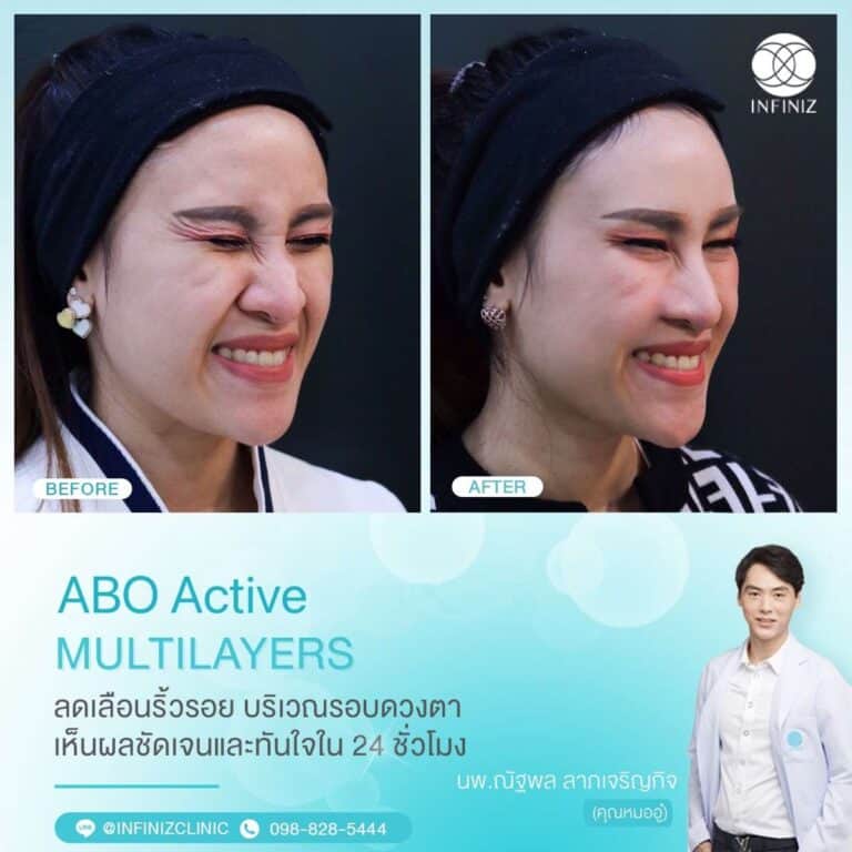 ABO Active 3 4