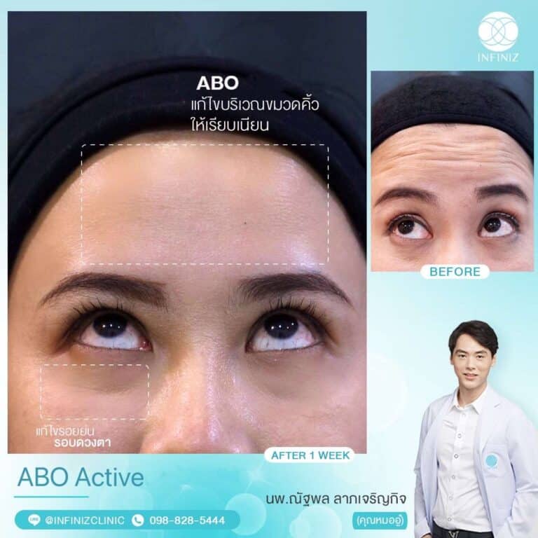 ABO Active 6 6