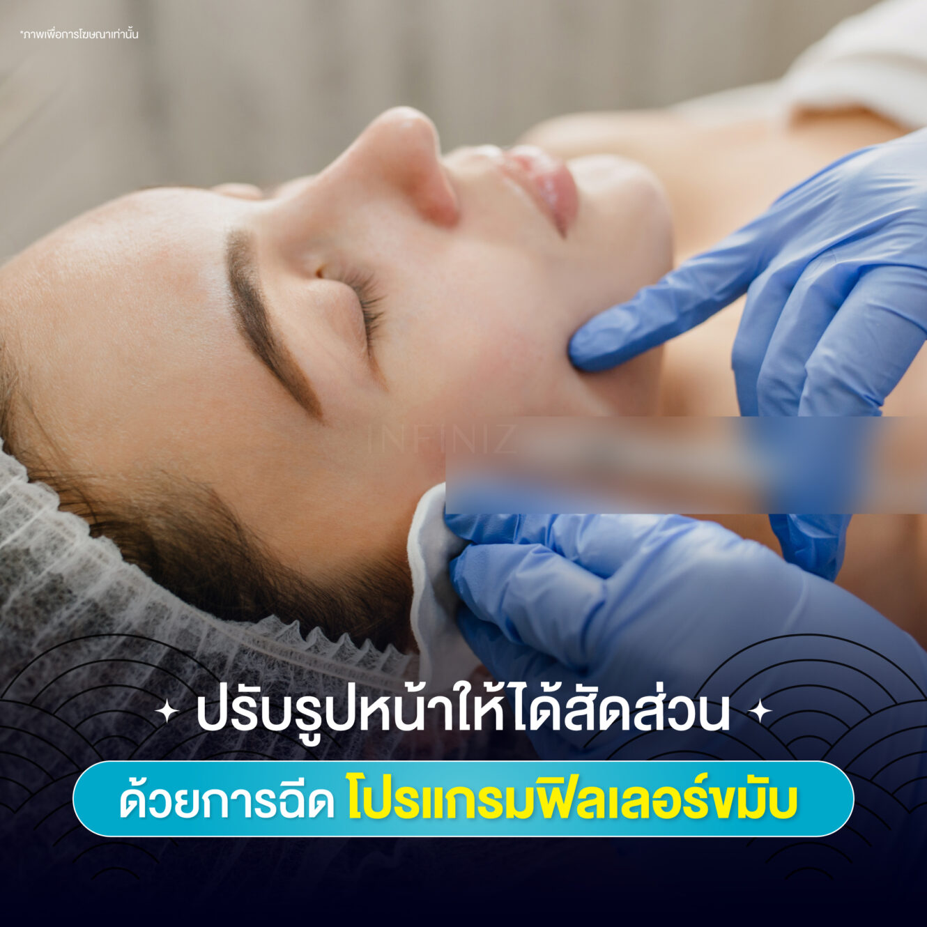สร้างมิติ ปรับรูปหน้าให้ได้สัดส่วนด้วยโปรแกรมฉีดฟิลเลอร์ขมับ 1 Web May 02