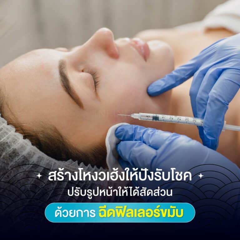 สร้างโหงวเฮ้งให้ปังรับโชค ปรับรูปหน้าให้ได้สัดส่วนด้วยการฉีดฟิลเลอร์ขมับ 6 ฟิลเลอร์ขมับ