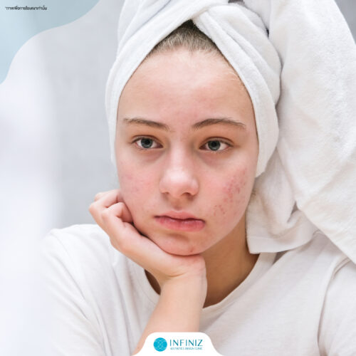 Skinvive โปรแกรมฟิลเลอร์ผิววิบวับ แลดูอิ่มน้ำ 1 Web Aug 05 1