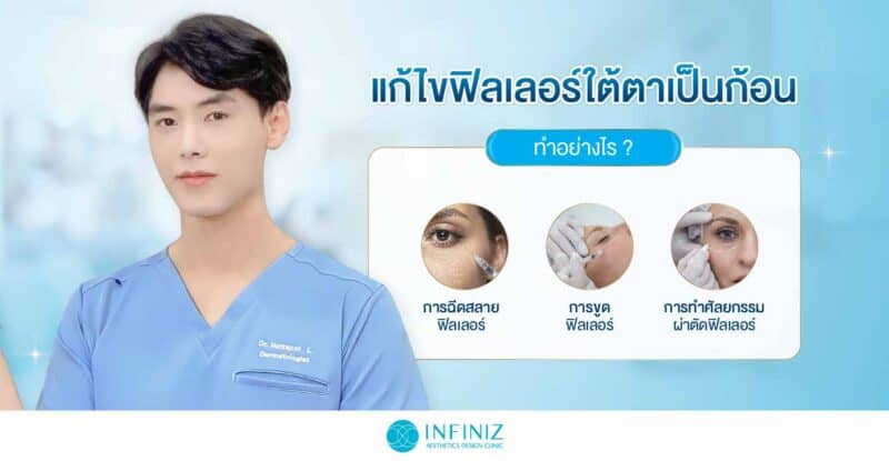 ตอบคำถามที่หลายคนสงสัย สามารถแก้โปรแกรมฟิลเลอร์ใต้ตาเป็นก้อนได้ไหม 3 วิธีแก้ฟิลเลอร์ใต้ตาเป็นก้อน