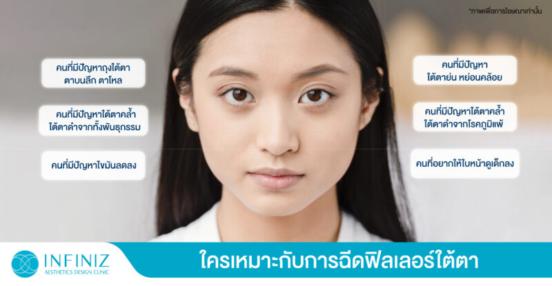 บอกลาปัญหา! ใต้ตาคล้ำ ตาลึก ตาโหลด้วย Filler จาก Infiniz Clinic 3 web Sep 23 06
