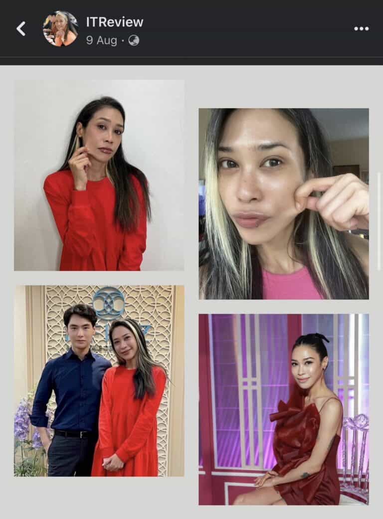 คุณทราย เจริญปุระ เข้ามาปรับรูปหน้ากับคุณหมออู๋ ณัฐพล ด้วย โปรแกรมการฉีด Sculptra 5 SAI3