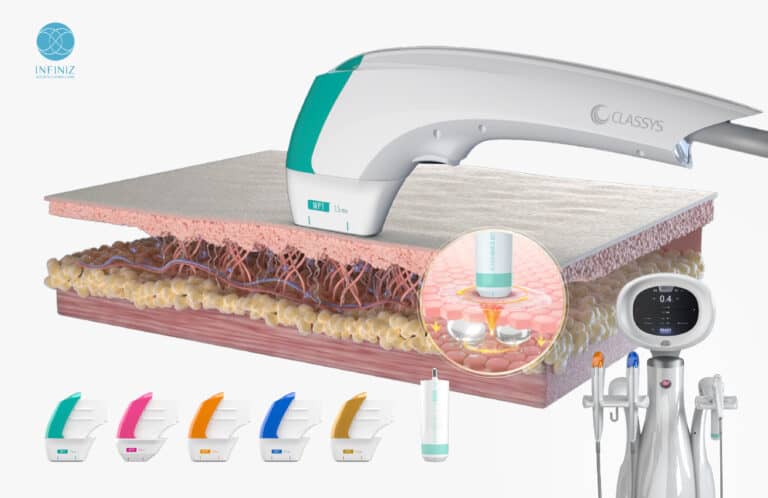 โปรแกรม Ultraformer MPT ตัวช่วยยกกระชับผิว ลดริ้วรอย พร้อมลดไขมันในเครื่องเดียว 3 Ultraformer MPT เหมาะกับใคร