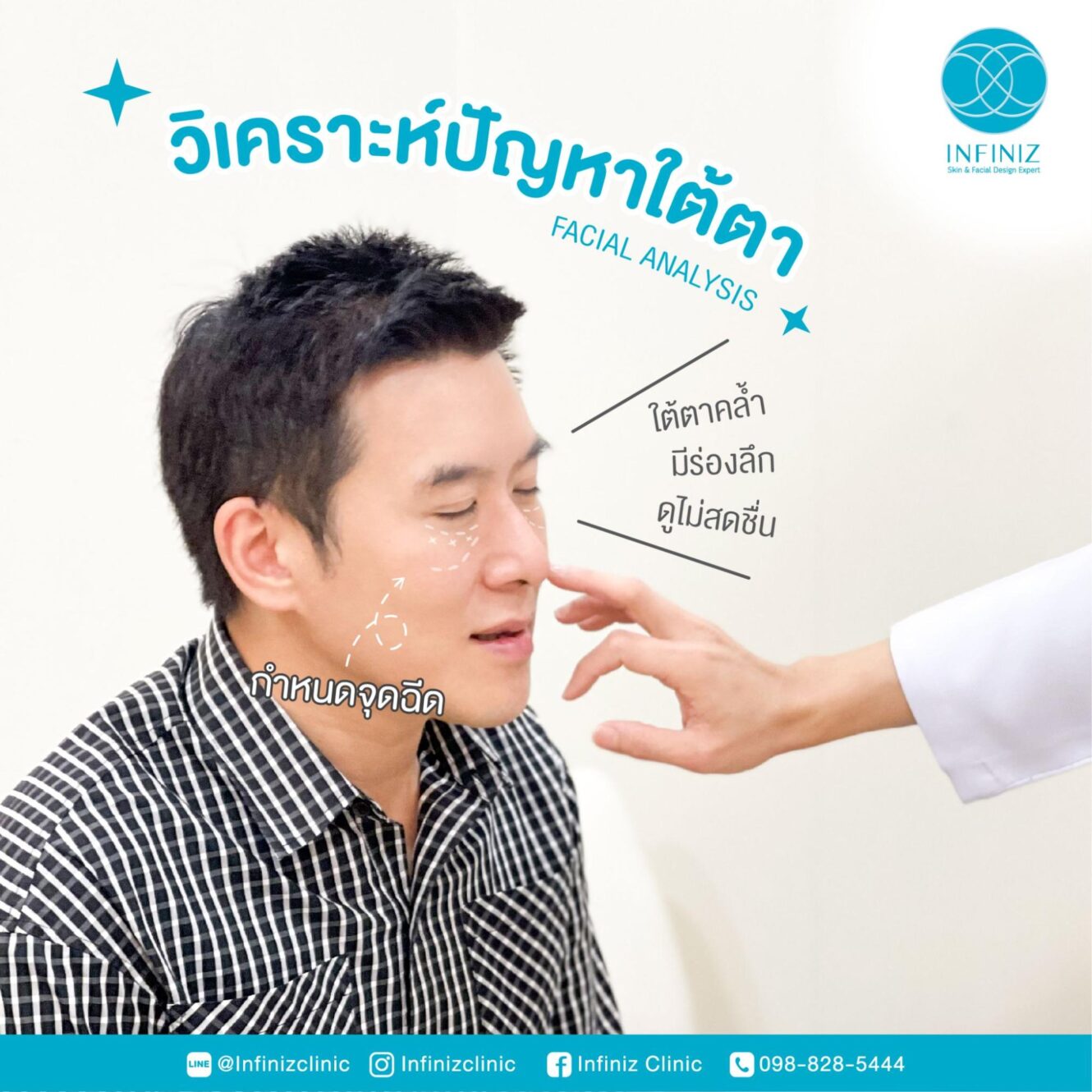 ฉีดโปรแกรมฟิลเลอร์ใต้ตาที่ไหนดี? ให้ไม่เป็นก้อน แลดูเป็นธรรมชาติ 3 ฟิลเลอร์ใต้ตา