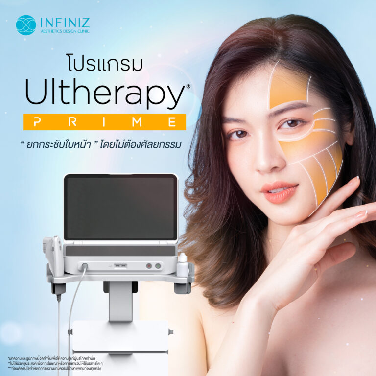 โปรแกรม Ulthera ด้วยเทคนิคจาก Infiniz ทำให้เจ็บลดลง 80% 7 Infiniz Ulthera apr 07