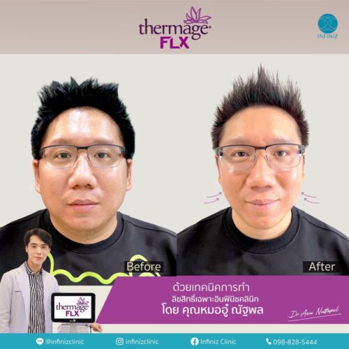 งานประชุม DST(Dermatology Society of Thailand) ครั้งที่ 48 “The Future Trend in Dermatology” 3 S 6275081 0