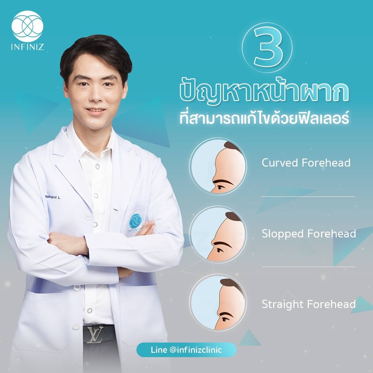 โปรแกรมฉีดฟิลเลอร์หน้าผาก เติมเต็มความอ่อนเยาว์และลดเลือดริ้วรอย 3 ประโยชน์ของการฉีดฟิลเลอร์หน้าผาก