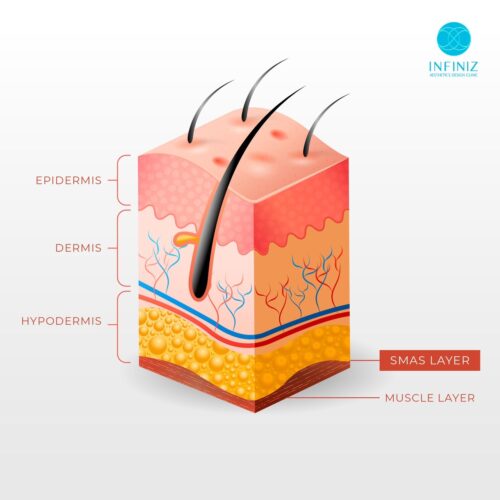 โปรแกรมUltraformer MPT ที่ Infiniz Clinic ด้วยแพทย์ สร้างผลลัพธ์กระชับผิวครบทุกชั้น 2 S 6553606 0