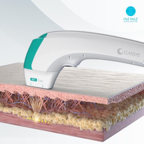 โปรแกรมUltraformer MPT ที่ Infiniz Clinic ด้วยแพทย์ สร้างผลลัพธ์กระชับผิวครบทุกชั้น 3 S 6553609 0 1