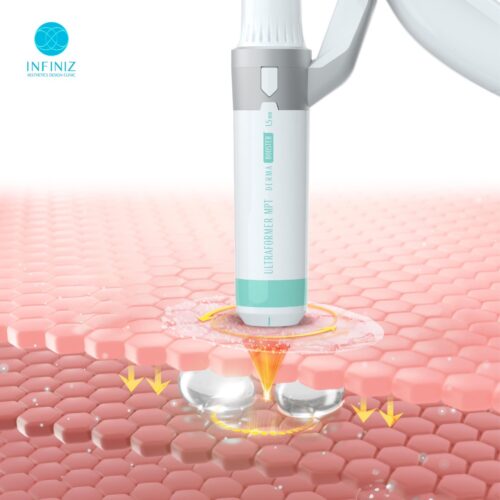 โปรแกรมUltraformer MPT ที่ Infiniz Clinic ด้วยแพทย์ สร้างผลลัพธ์กระชับผิวครบทุกชั้น 5 S 6553611 0