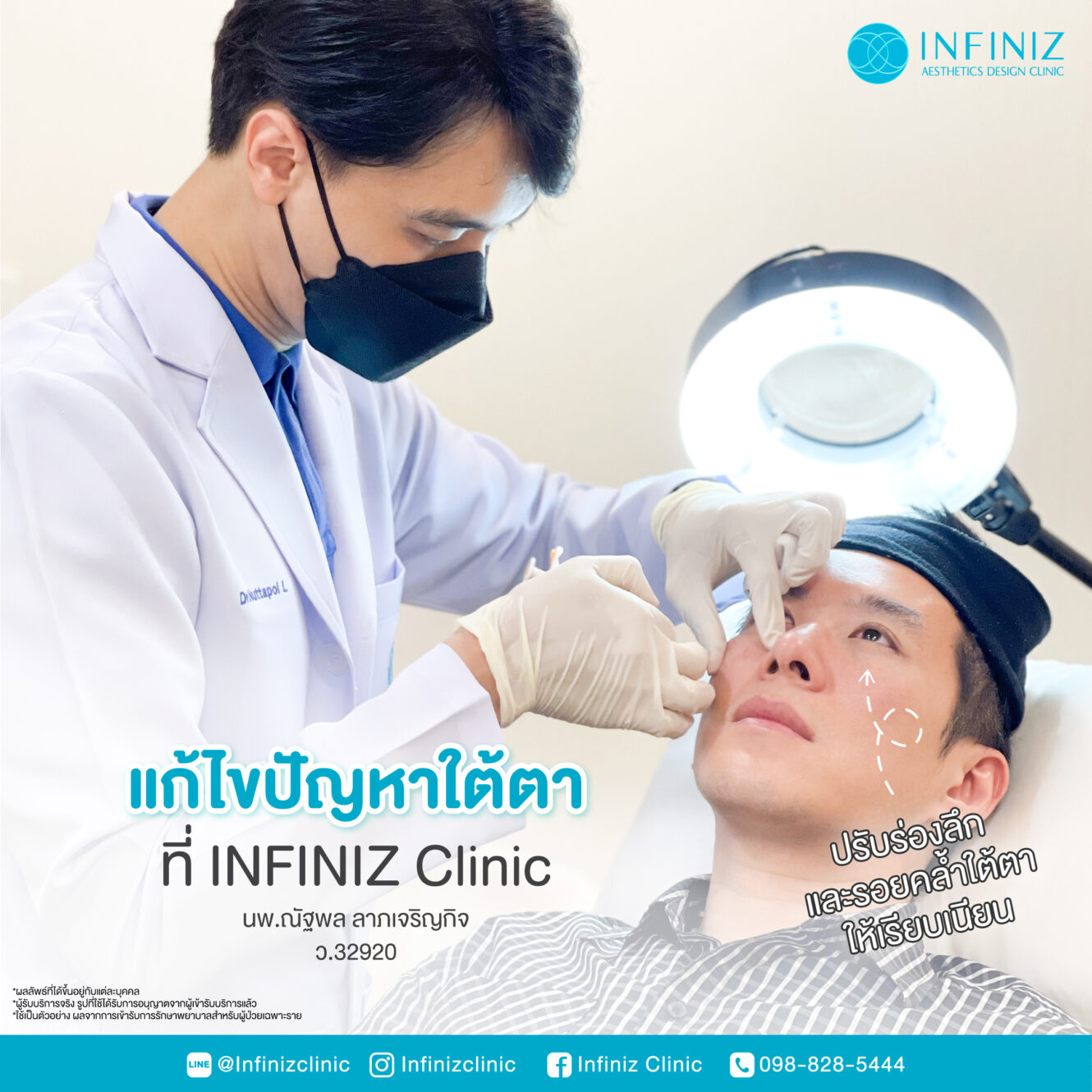 Anatomy บริเวณใต้ตา (Tear Trough Anatomy) 2 Web Jan 26 16