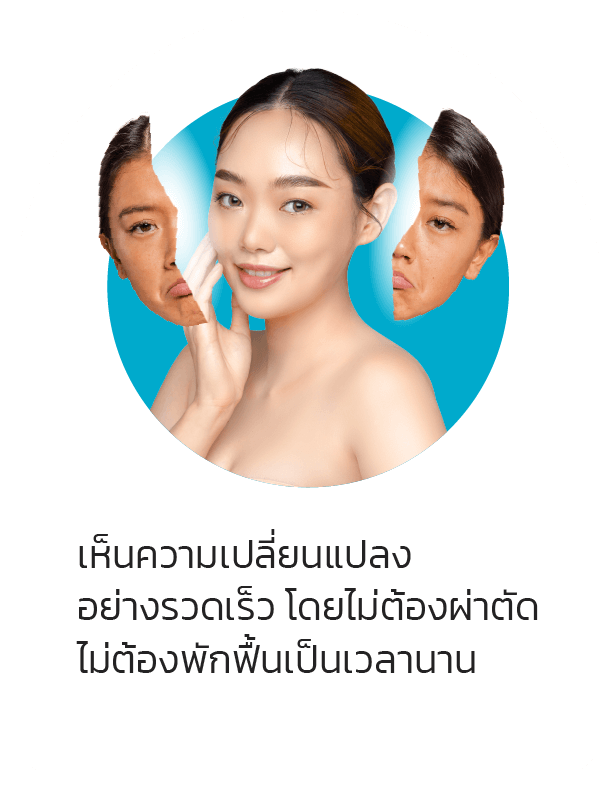 เห็นความเปลี่ยนแปลงอย่างรวดเร็ว