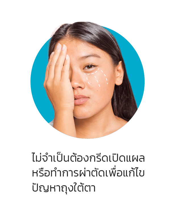 ไม่จำเป็นต้องกรีดเปิดแผล