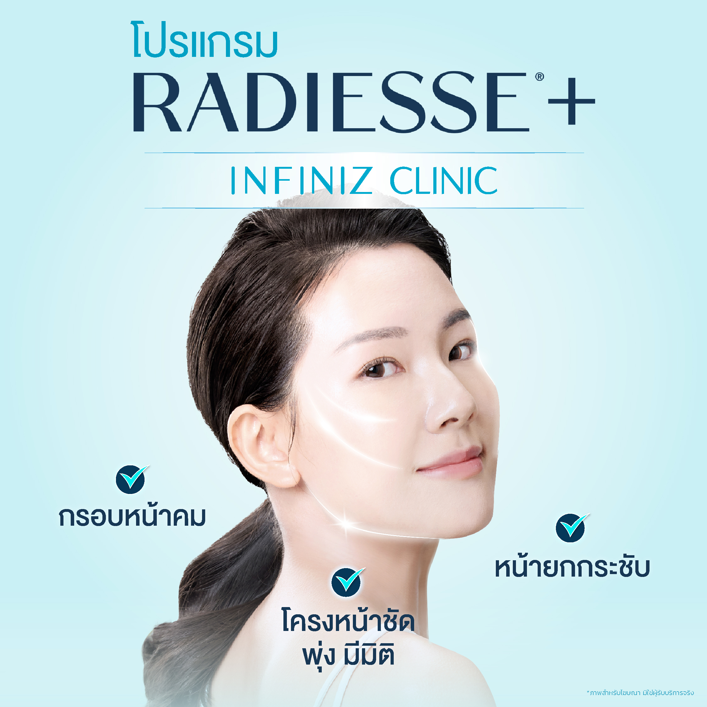 โปรแกรม Radiesse Plus เสริมกรอบหน้าให้คมชัด อย่างมีมิติ 3 Radiess 02