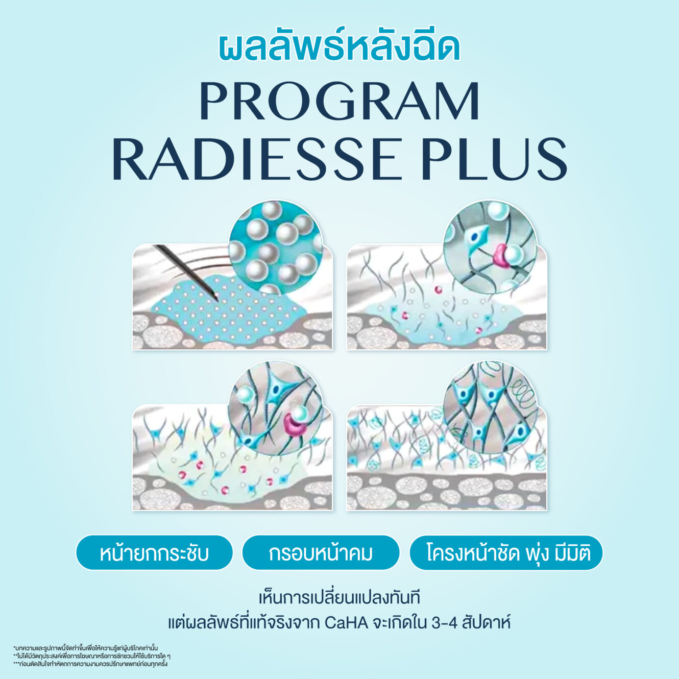 Radiess 04 1