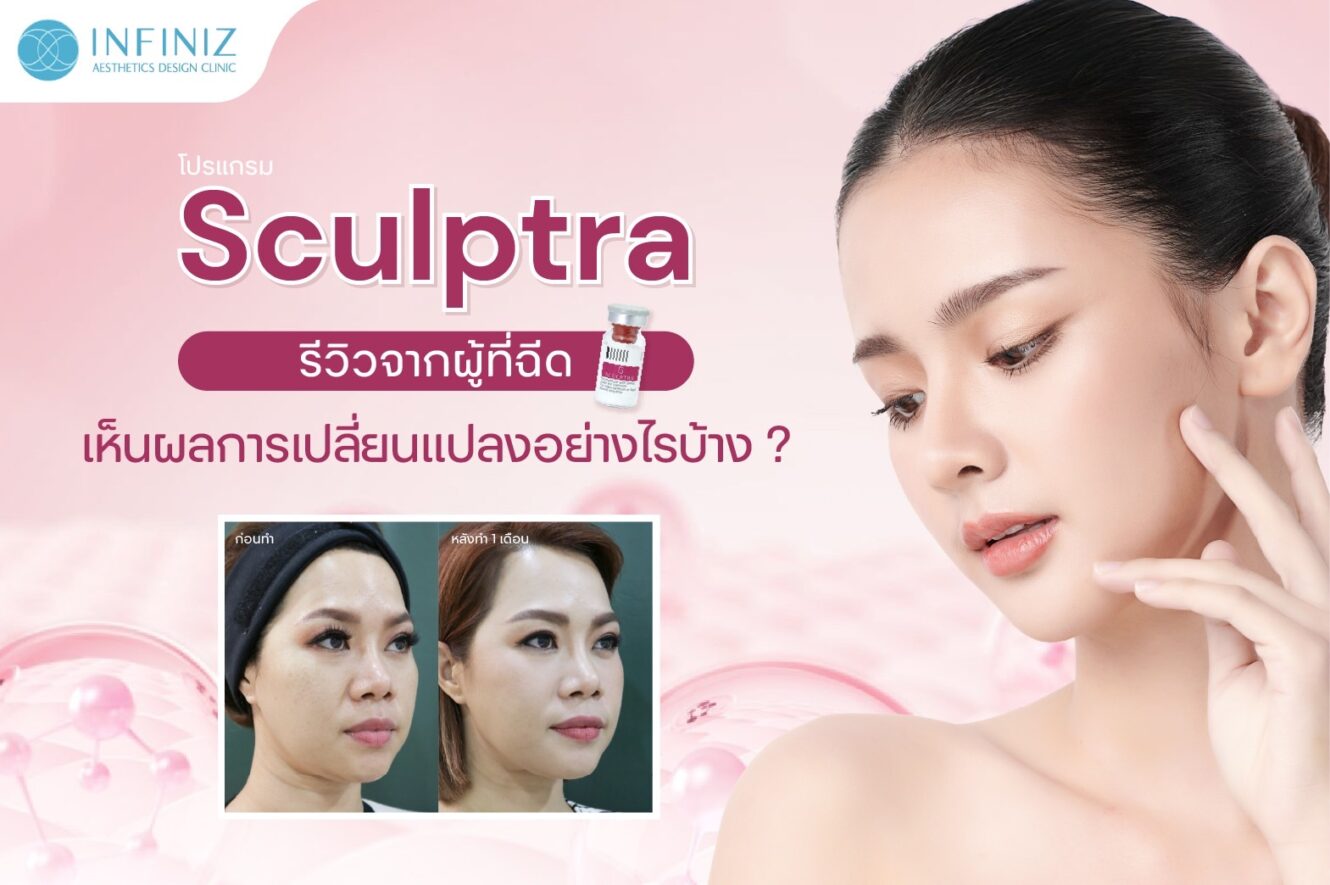โปรแกรม Sculptra รีวิวจากผู้ที่ฉีด เห็นผลการเปลี่ยนแปลงอย่างไรบ้าง 1 Sculptra รีวิว