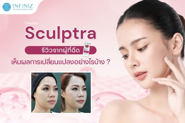 โปรแกรม Sculptra รีวิวจากผู้ที่ฉีด เห็นผลการเปลี่ยนแปลงอย่างไรบ้าง 2 Sculptra รีวิว
