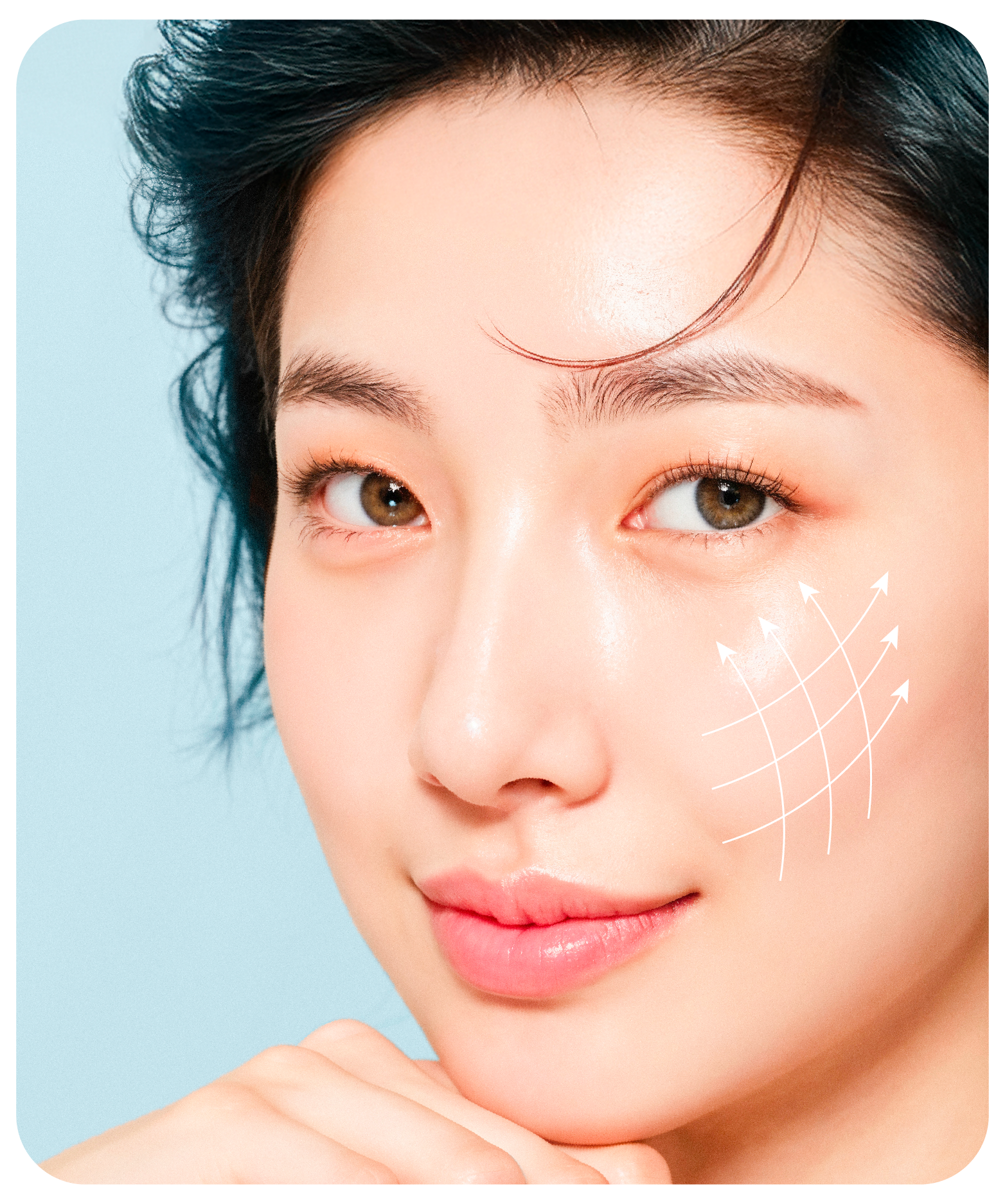 โปรแกรมร้อยไหม คืนความอ่อนเยาว์กระชับผิวโดยไม่ต้องผ่าตัด 4 04 บริเวณ Thread Lift