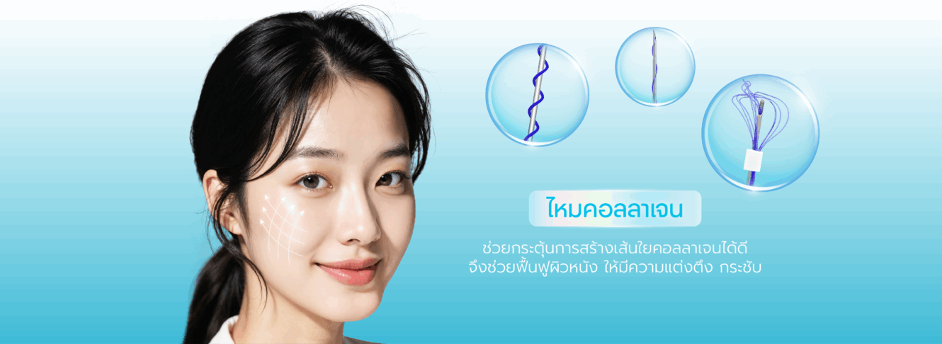 โปรแกรมร้อยไหม คืนความอ่อนเยาว์กระชับผิวโดยไม่ต้องผ่าตัด 7 07 PCไหมคอลลาเจน Thread Lift