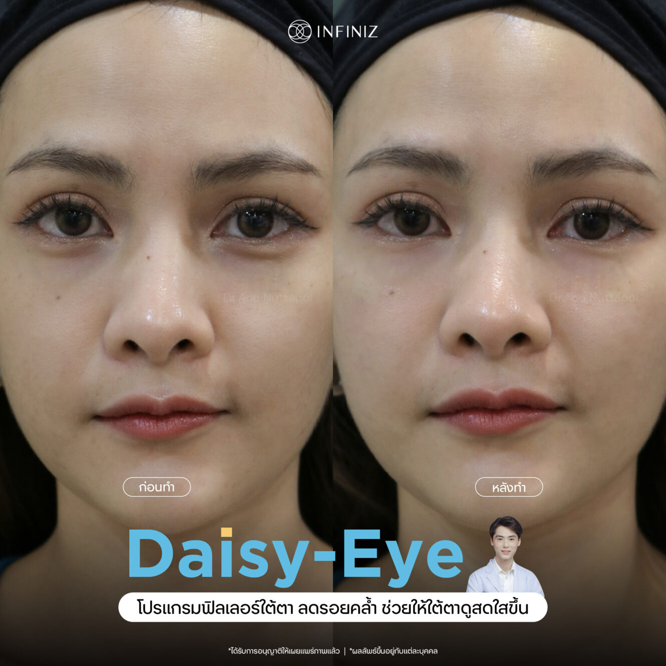 แพทย์ 12 web BA eyes 09 1