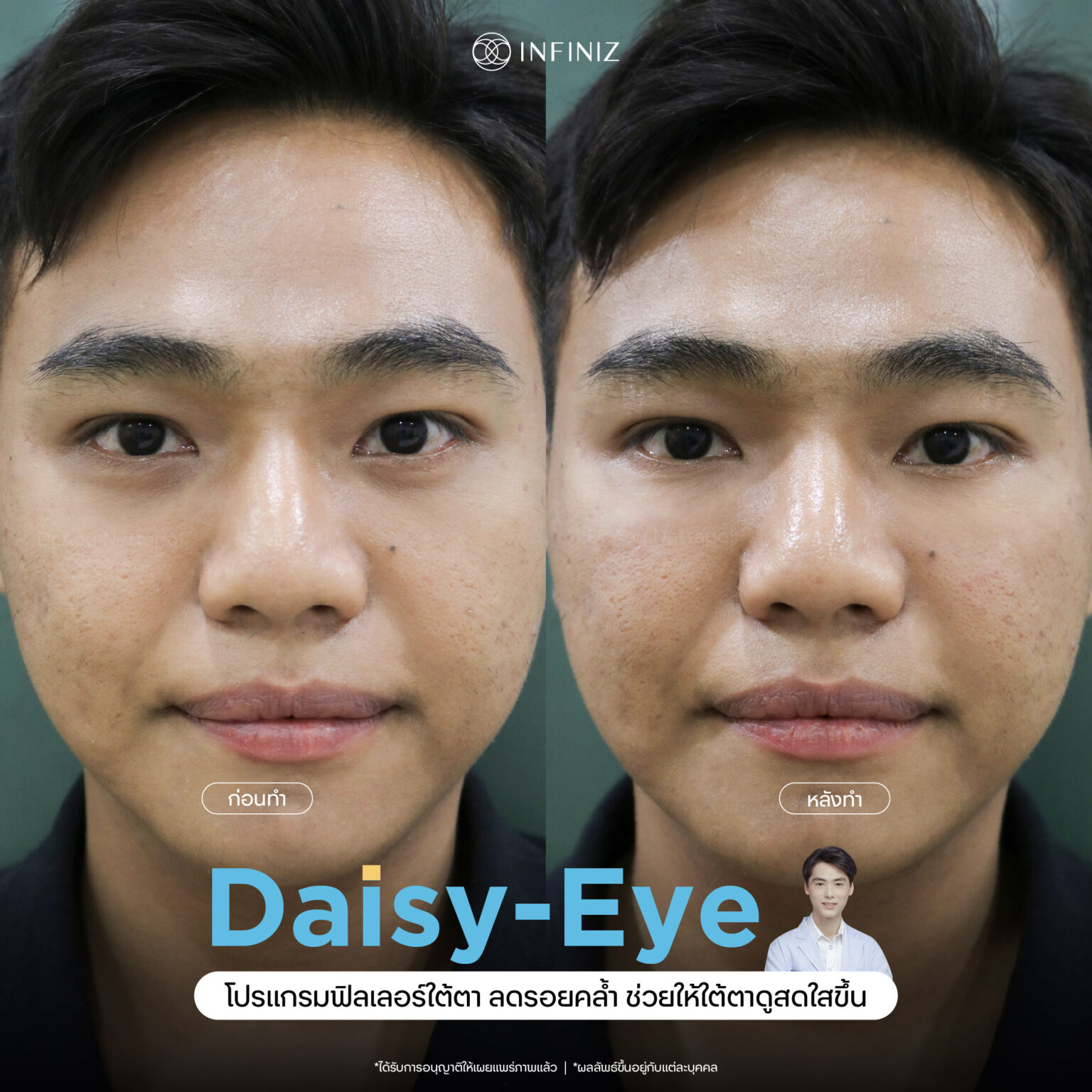 web B&A - eyes-10