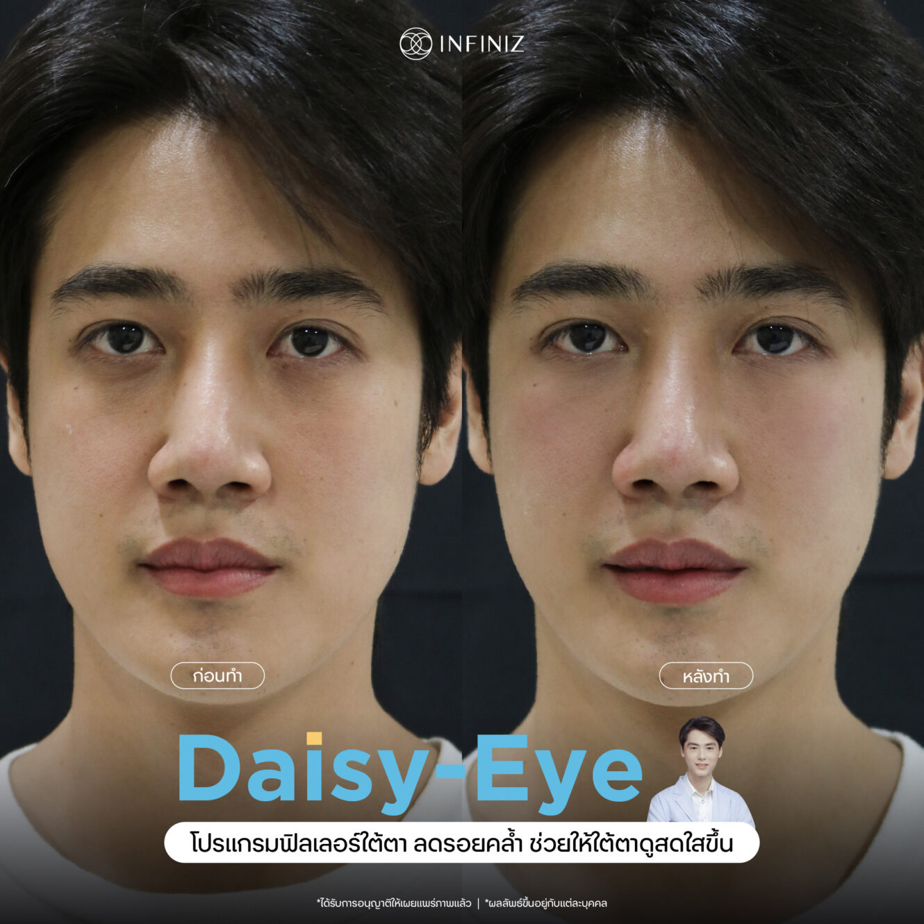 แพทย์ 13 web BA eyes 11 1