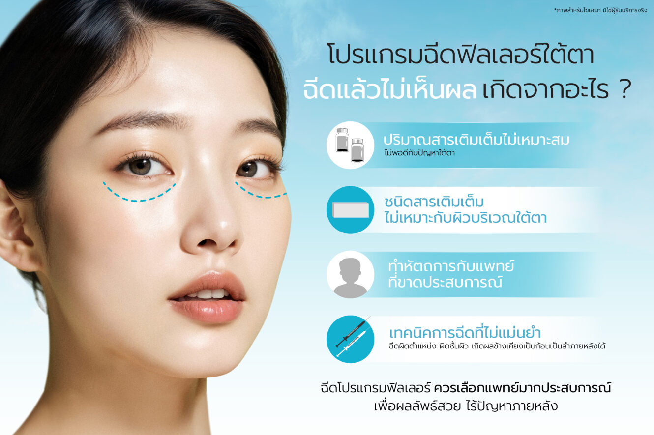 โปรแกรมฉีดฟิลเลอร์ใต้ตากี่วันเห็นผล? บวมนานไหม กี่วันยุบ? ควรดูแลตัวเองอย่างไร 5 web banner Jun 25 06 1