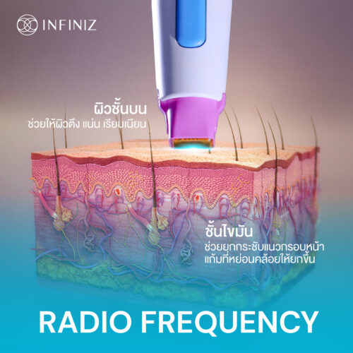 โปรแกรม Thermage FLX คืออะไรและมีหลักการทำงานอย่างไร เพื่อยกกระชับผิวหน้า 4 Web Sep 25 10
