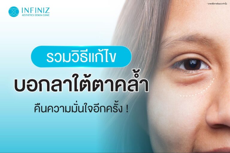 ตาโหล รวมวิธีแก้ไข บอกลาใต้ตาคล้ำ คืนความมั่นใจอีกครั้ง! 9 ตาโหล