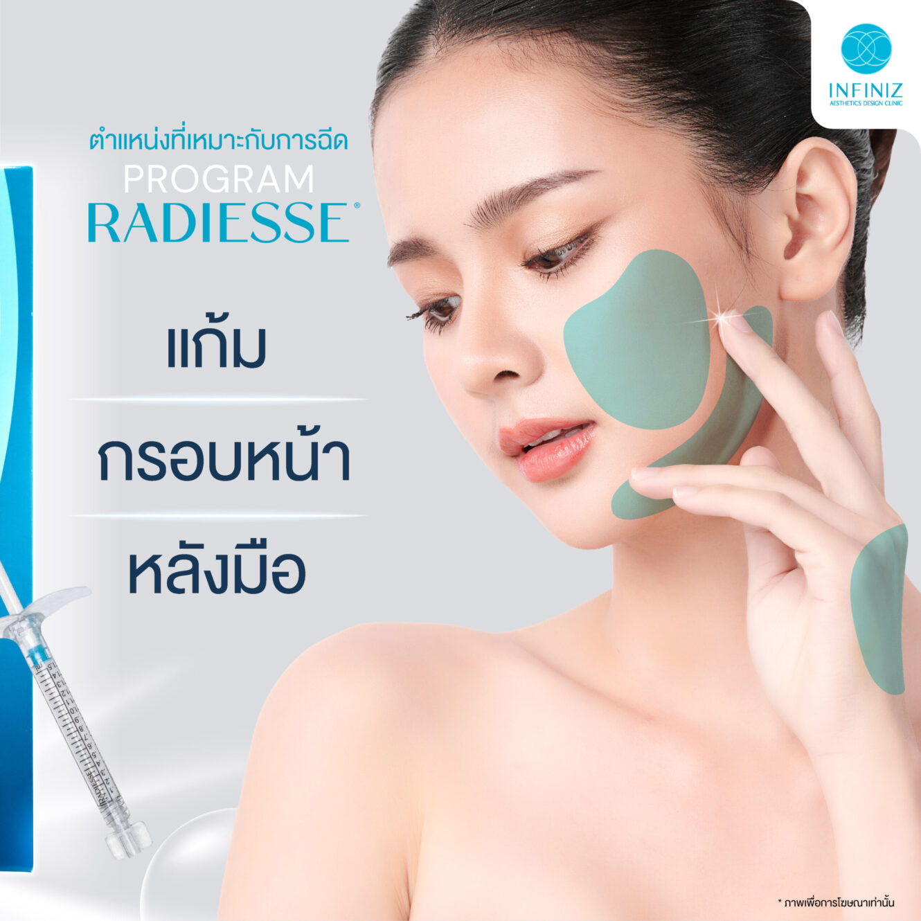เจาะลึกโปรแกรม Radiesse Filler คืออะไร ราคาเท่าไหร่ ต้องฉีดกี่ครั้งเพื่อฟื้นฟูผิว 3 radiesse Aw 03
