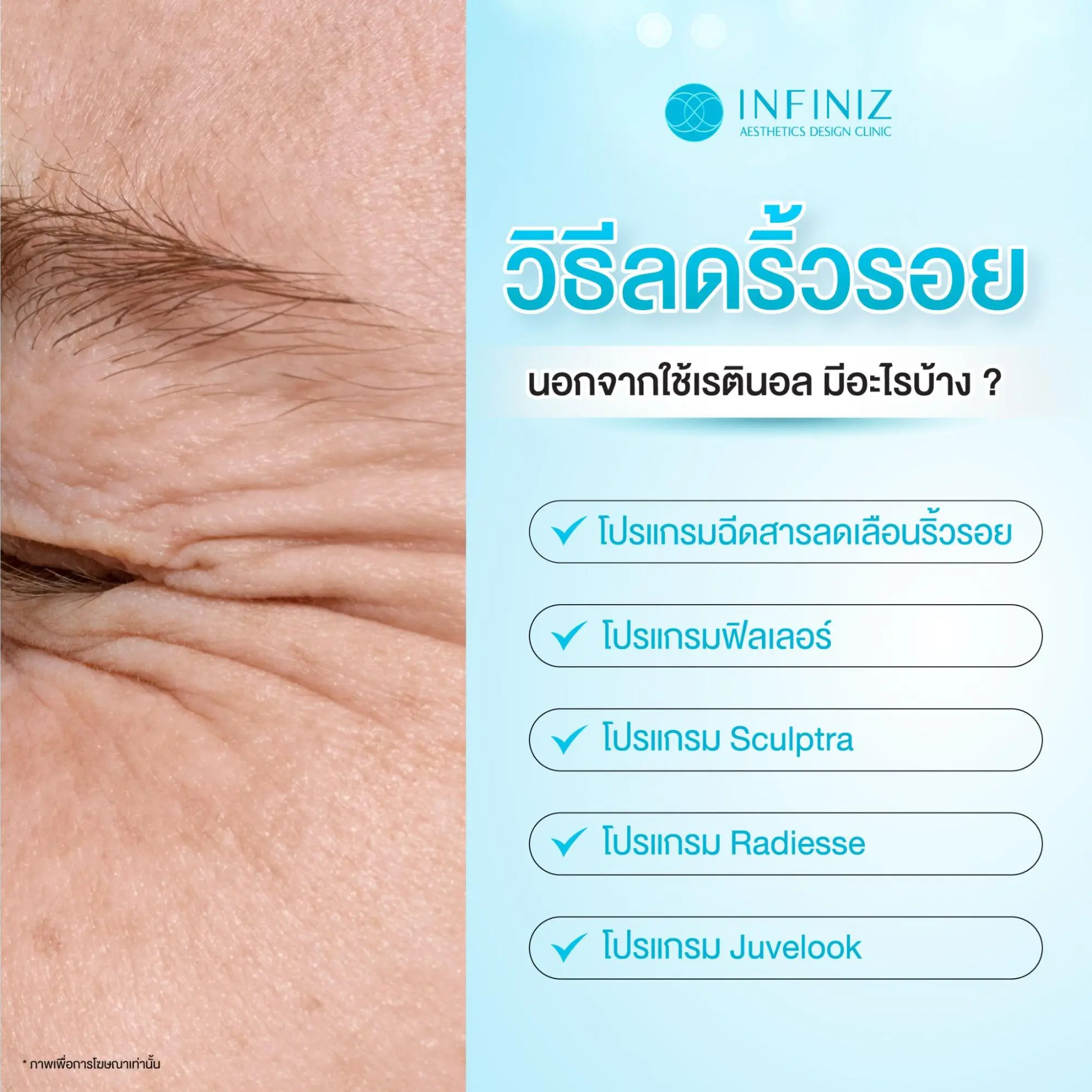 เรตินอล คืออะไร? ตัวช่วยลดริ้วรอยที่คนรักผิวต้องรู้จัก 4 retinol คือ