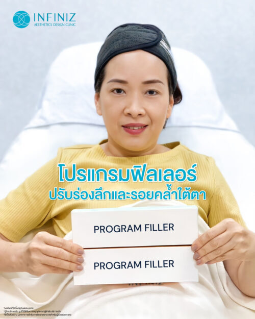โปรแกรมฟิลเลอร์ Restylane ดีไหม ของแท้ดูอย่างไร ราคาเท่าไหร่บ้าง และข้อควรรู้ก่อนฉีด 3 fillrt effect eye 12