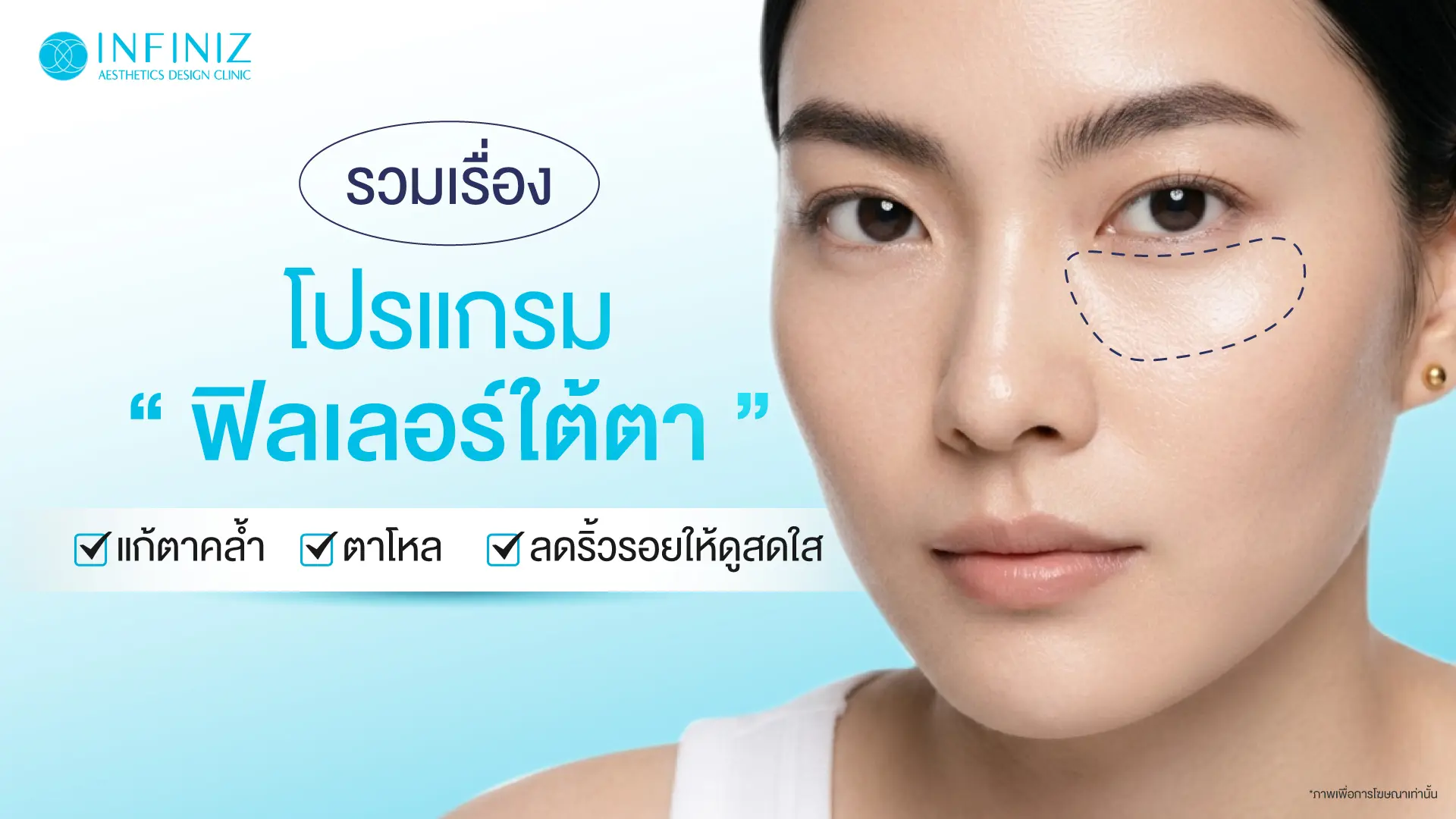 รู้ก่อนทำ! รวมเรื่อง ‘โปรแกรมฟิลเลอร์ใต้ตา’ แก้ตาคล้ำ ตาโหล ลดริ้วรอยให้ดูสดใส 1 โปรแกรมฟิลเลอร์ใต้ตา