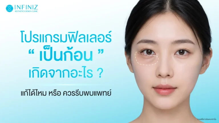 โปรแกรมฟิลเลอร์เป็นก้อนเกิดจากอะไร? แก้ได้ไหม หรือควรรีบพบแพทย์ 3 โปรแกรมฟิลเลอร์เป็นก้อน