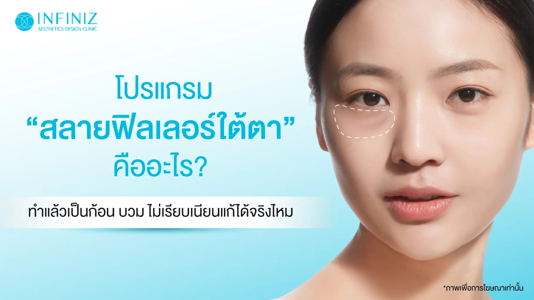 สลายโปรแกรมฟิลเลอร์ใต้ตาคืออะไร? ทำแล้วเป็นก้อน บวม ไม่เรียบเนียนแก้ได้จริงไหม 1 dissolve under eye fillers