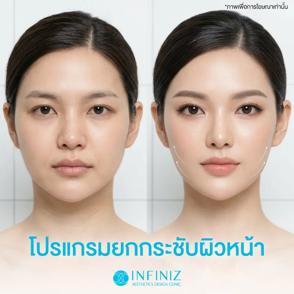 10 วิธียกกระชับหน้า เมื่อแก้มเริ่มหย่อน กรอบหน้าเริ่มหาย วิธีไหนตอบโจทย์คุณ? 8 รีวิวยกกระชับหน้า