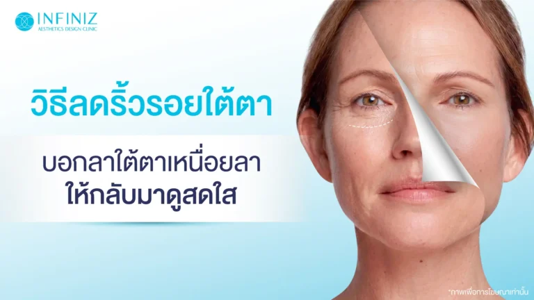 12 วิธีลดริ้วรอยใต้ตา บอกลาลุคเหนื่อย ให้ดวงตากลับมาดูสดใส 12 ริ้วรอยใต้ตา