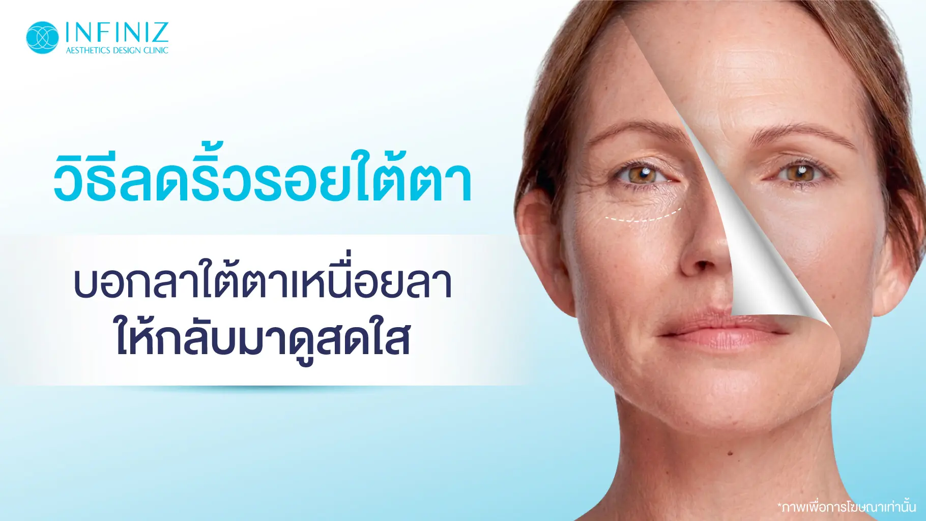 12 วิธีลดริ้วรอยใต้ตา บอกลาลุคเหนื่อย ให้ดวงตากลับมาดูสดใส 1 ริ้วรอยใต้ตา